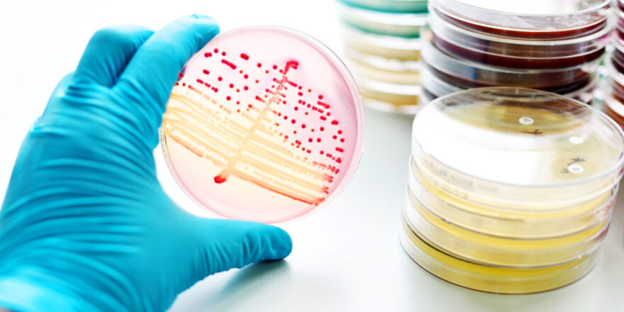 Colonies of bacteria in MacConkey agar (culture medium plate)